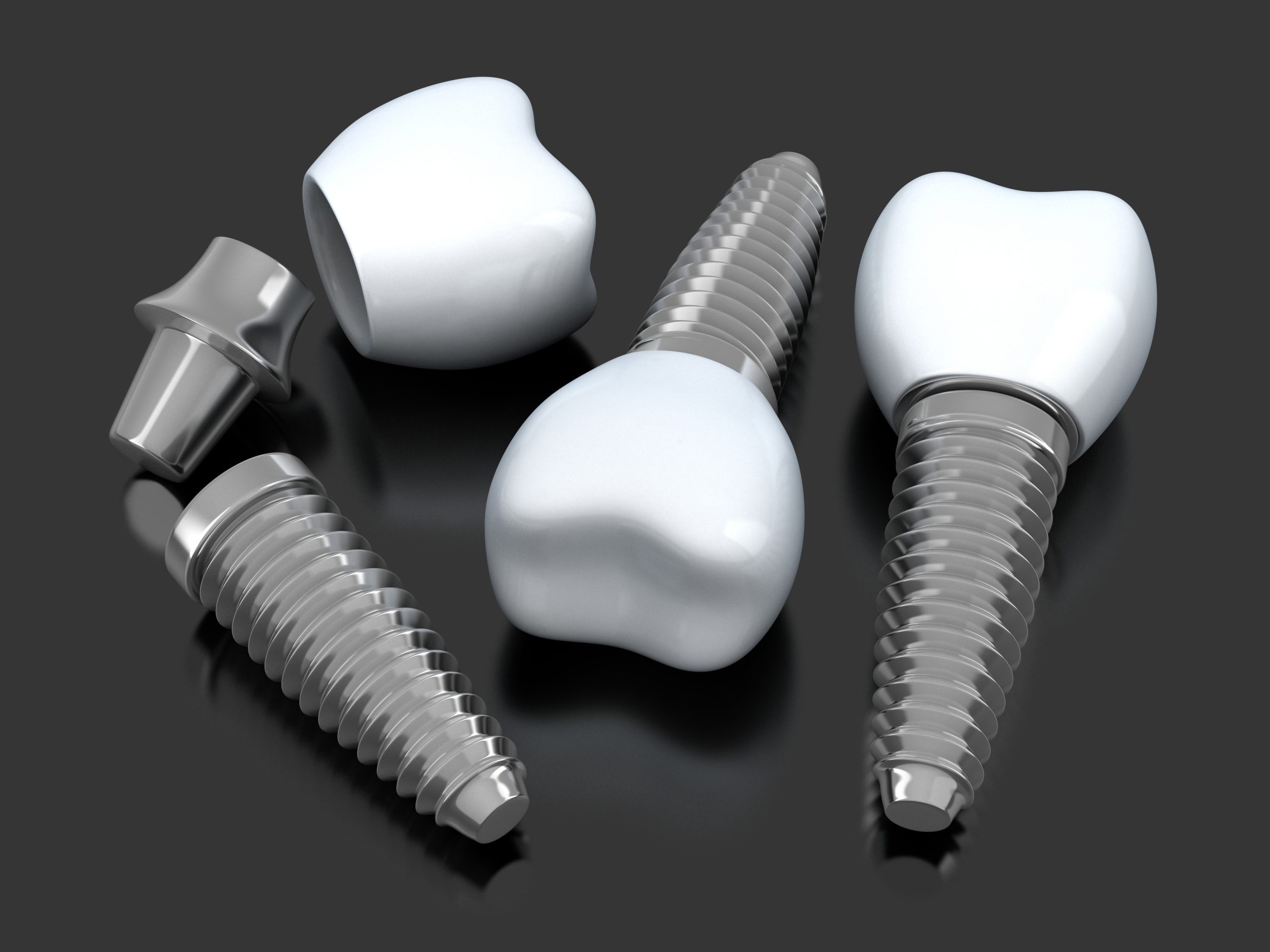Dental Implants Brands and Dental Implant Companies: Which ones are the most Indicated